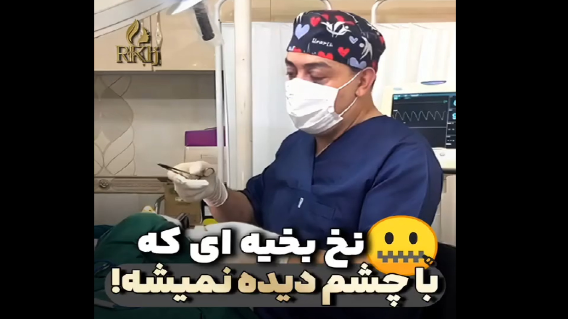 نخ بخیه در بلفاروپلاستی زاویه سازی صورت