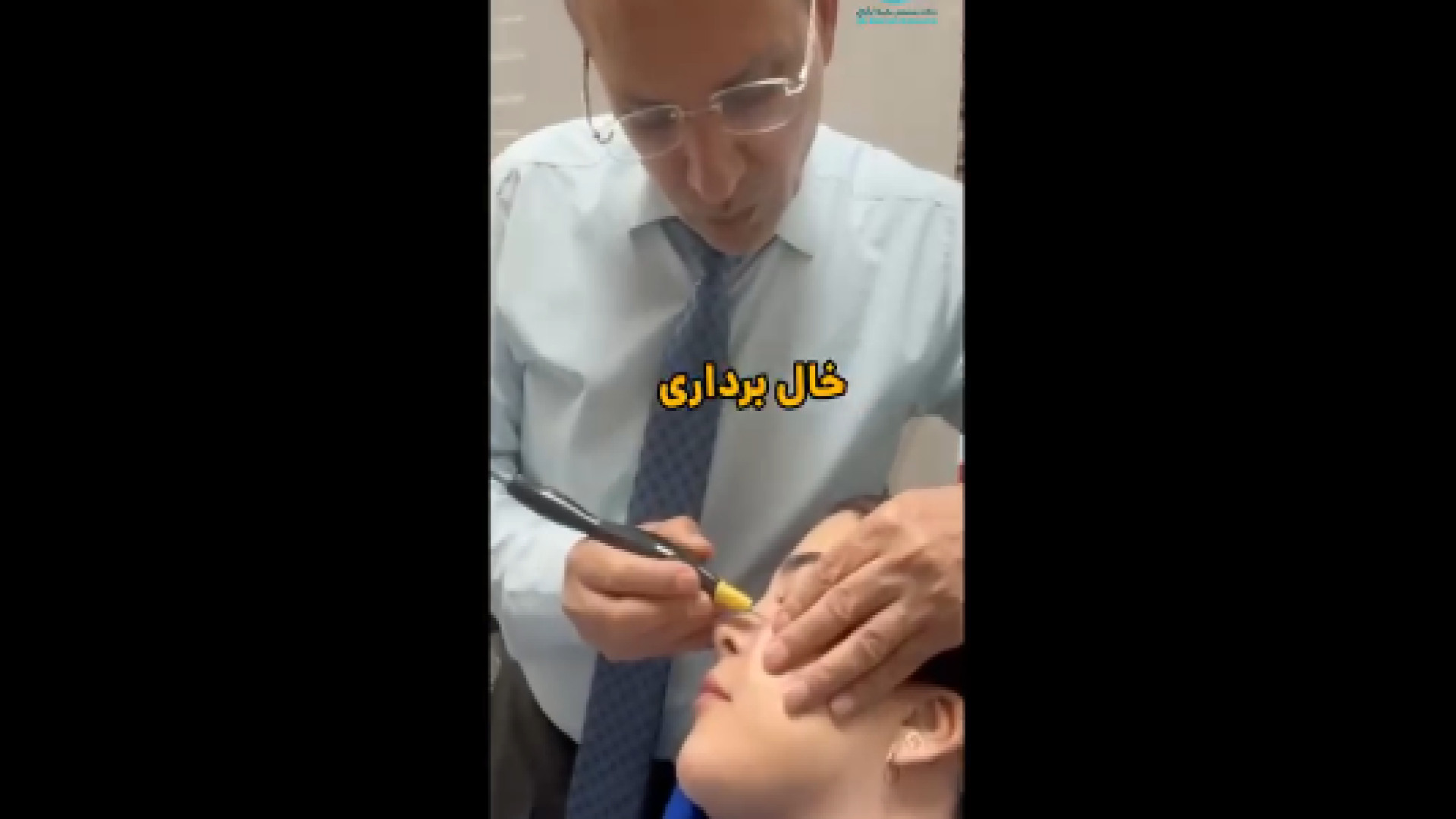 فیلم خال برداری صورت بیماری سندروم باتن