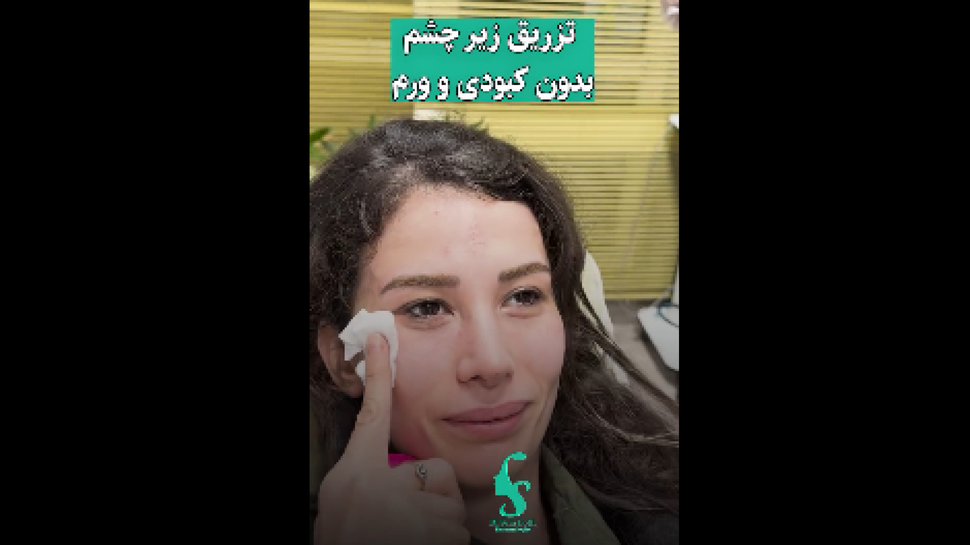 تزریق زیر چشم بدون کبودی دکتر سار ا لطفی