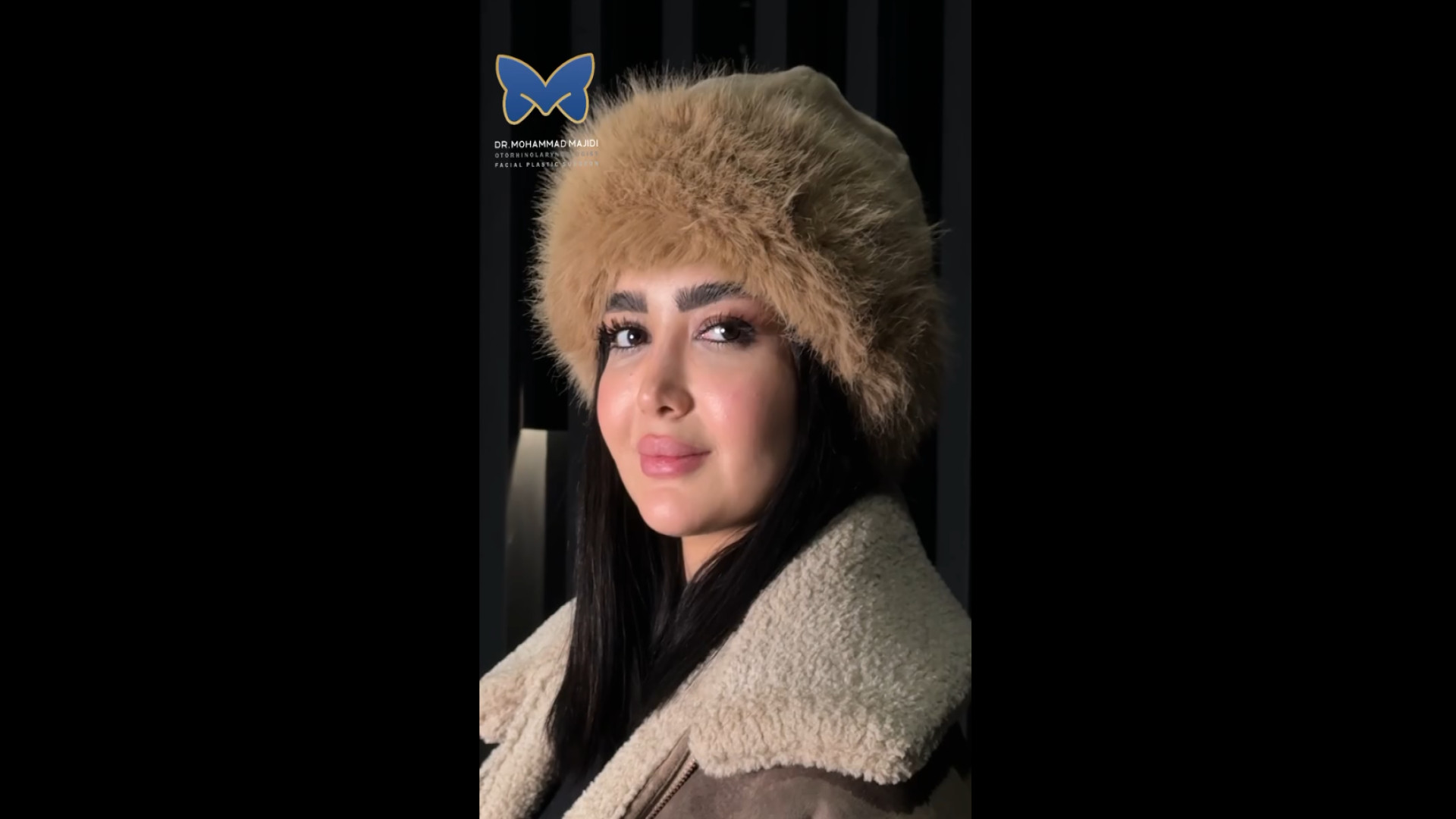 عمل بینی طبیعی شیک - متناسب با چهره | دکتر مجیدی دکتر محمد مجیدی - جراحی بینی به سبک طبیعی شیک