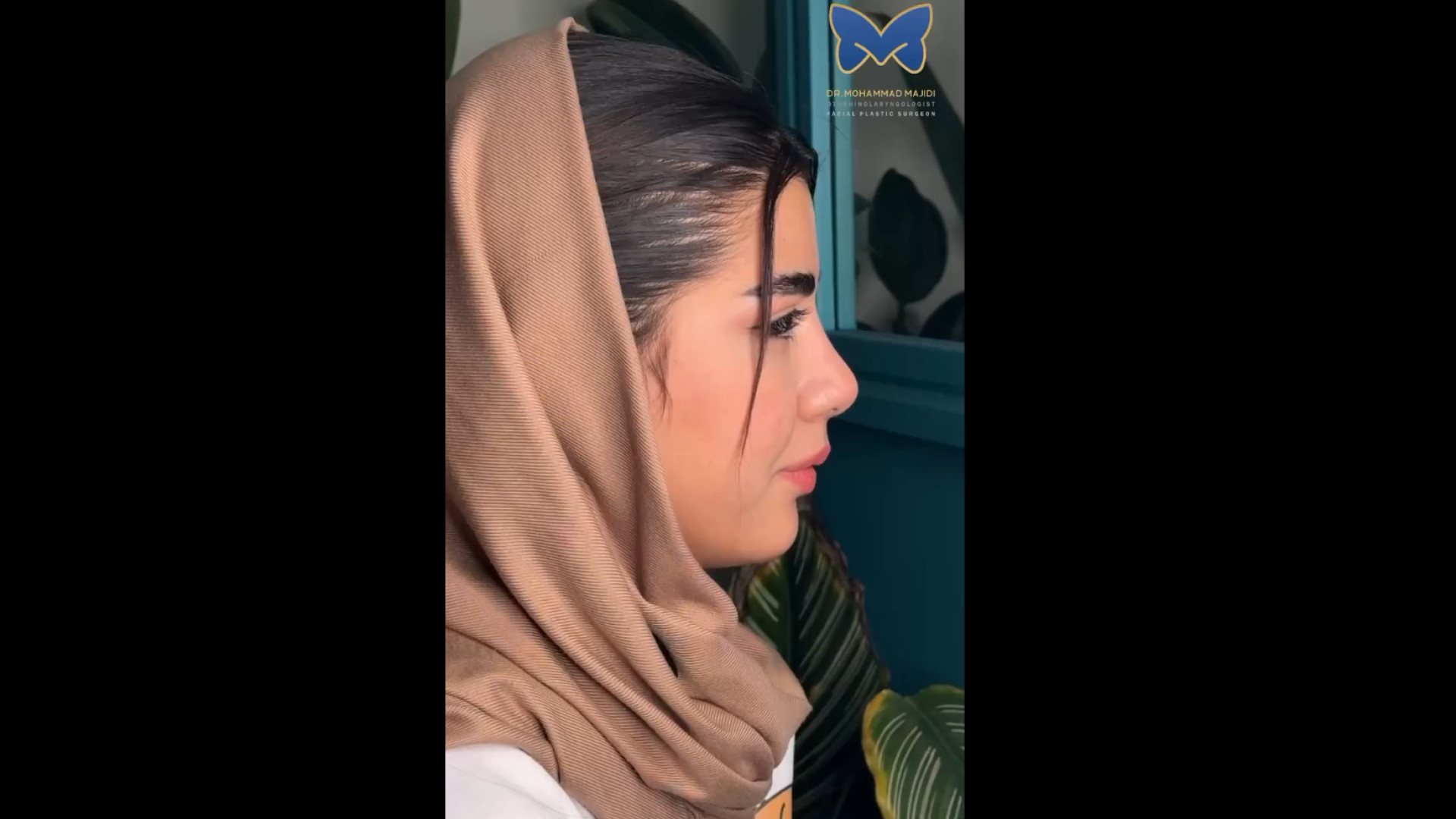 نتیجه عمل بینی طبیعی شیک توسط دکتر مجیدی دکتر محمد مجیدی - جراحی بینی به سبک طبیعی شیک