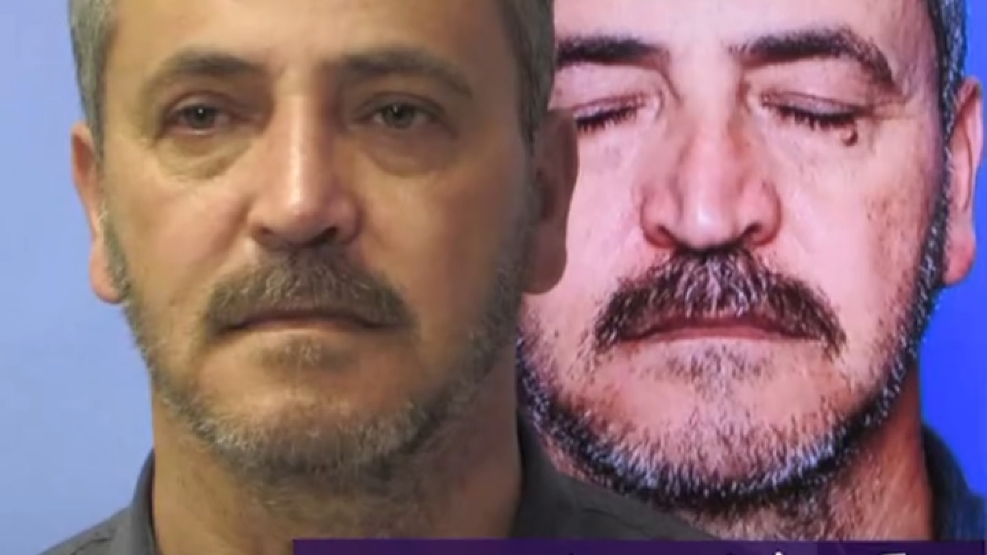 عمل زیبایی بینی به همراه جراحی زیبایی پلک و لیفت پیشانی | دکتر علی حسینی واجاری دکتر علی حسینی واجاری - جراح بینی رشت