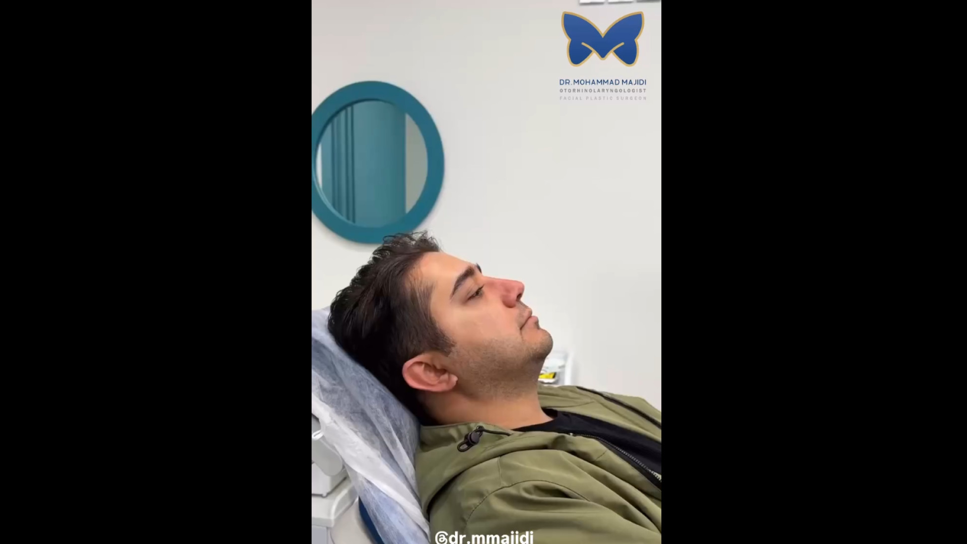 3 ماه بعد از جراحی بینی مردانه | دکتر مجیدی دکتر محمد مجیدی - جراحی بینی به سبک طبیعی شیک