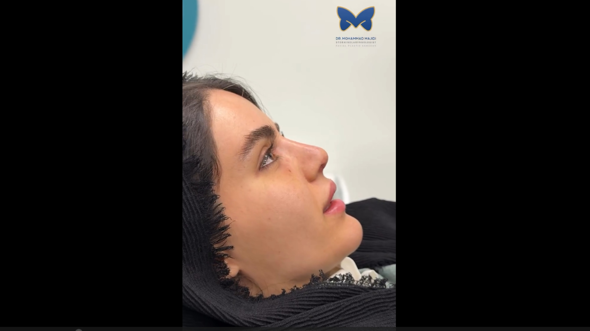 هفته اول عمل بینی غضروفی - استخوانی | دکتر محمد مجیدی دکتر محمد مجیدی - جراحی بینی به سبک طبیعی شیک