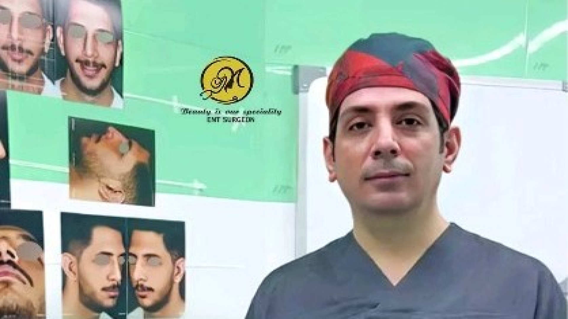 جراحی انحراف بینی شدید | دکتر مهدی بنائی