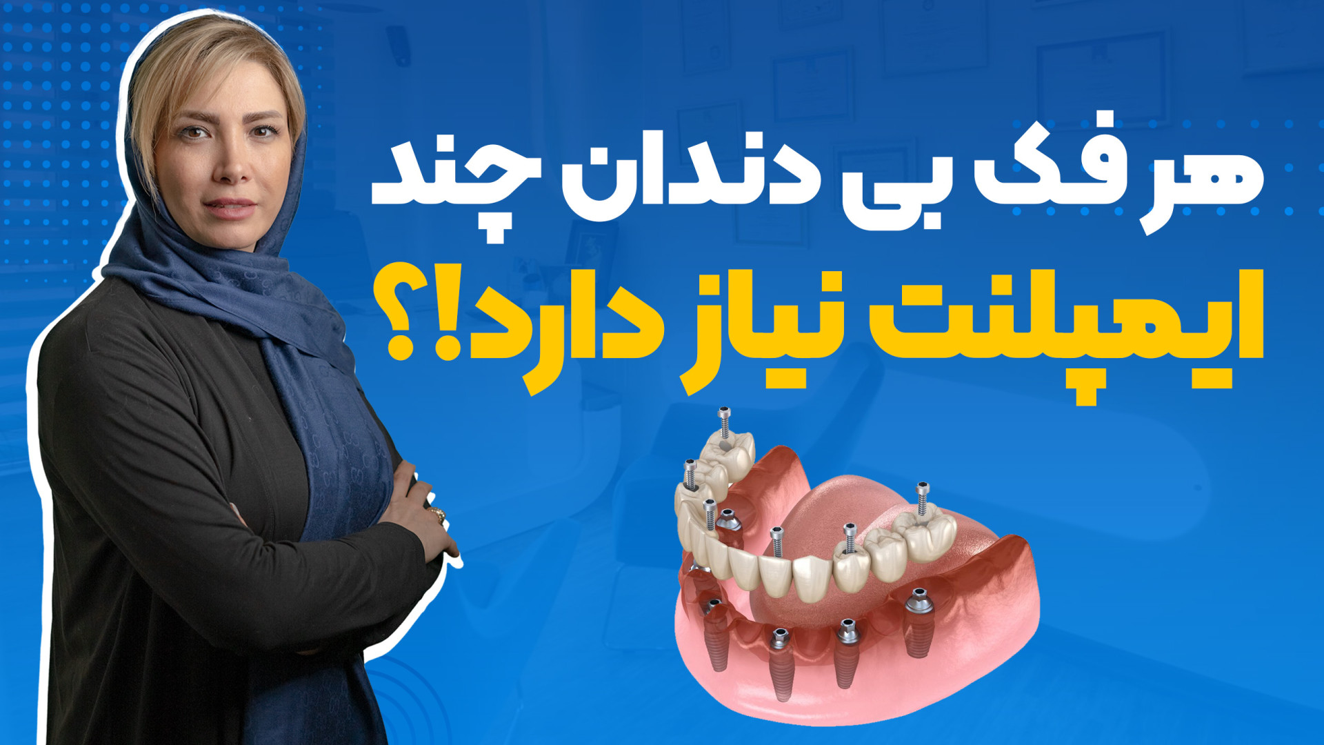 هر فک بی دندان چند ایمپلنت نیاز داره زاویه سازی صورت