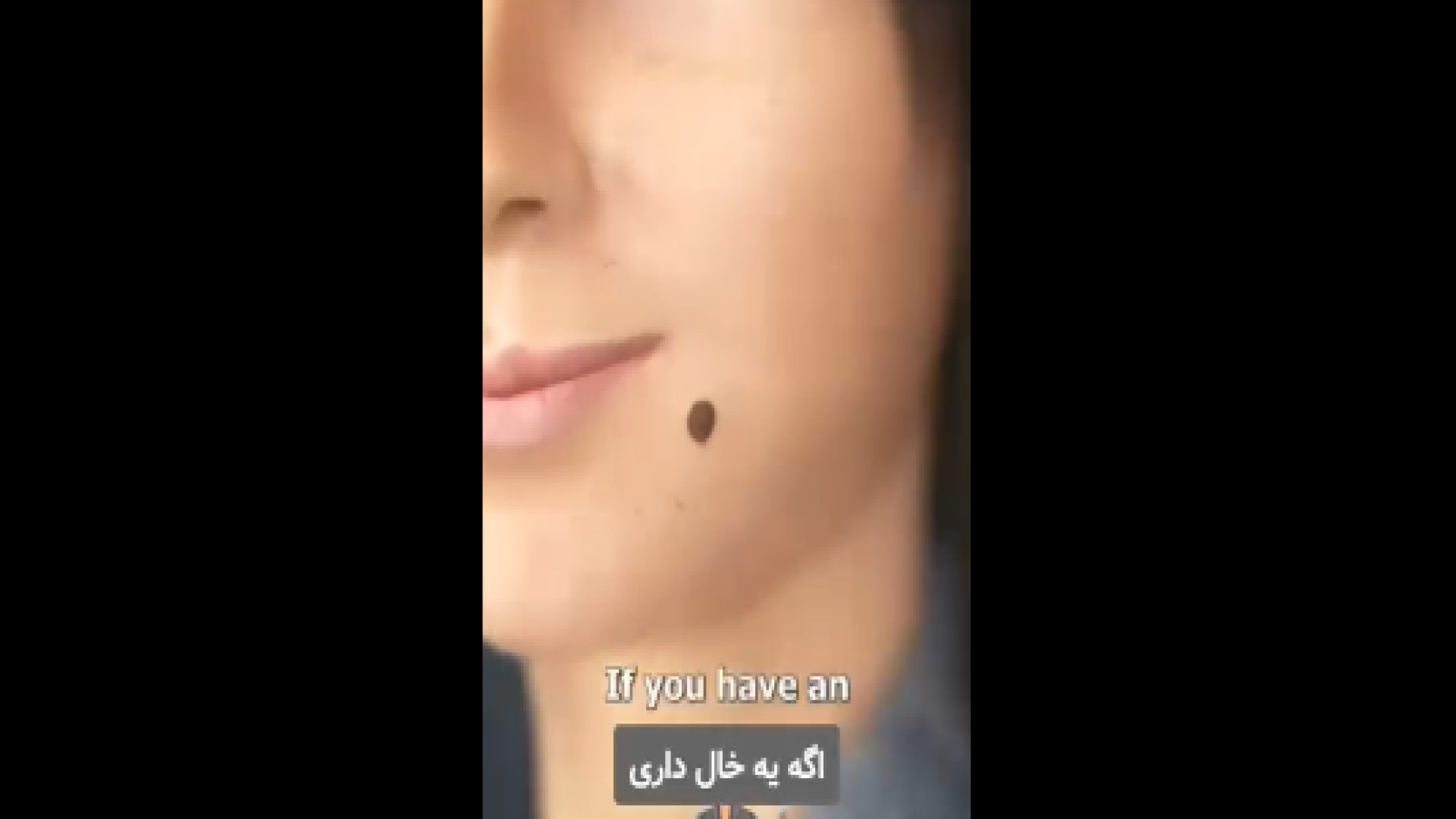 خال بدن رو دستکاری نکنید! دکتر ایمان روغنی جراح و متخصص پوست و مو