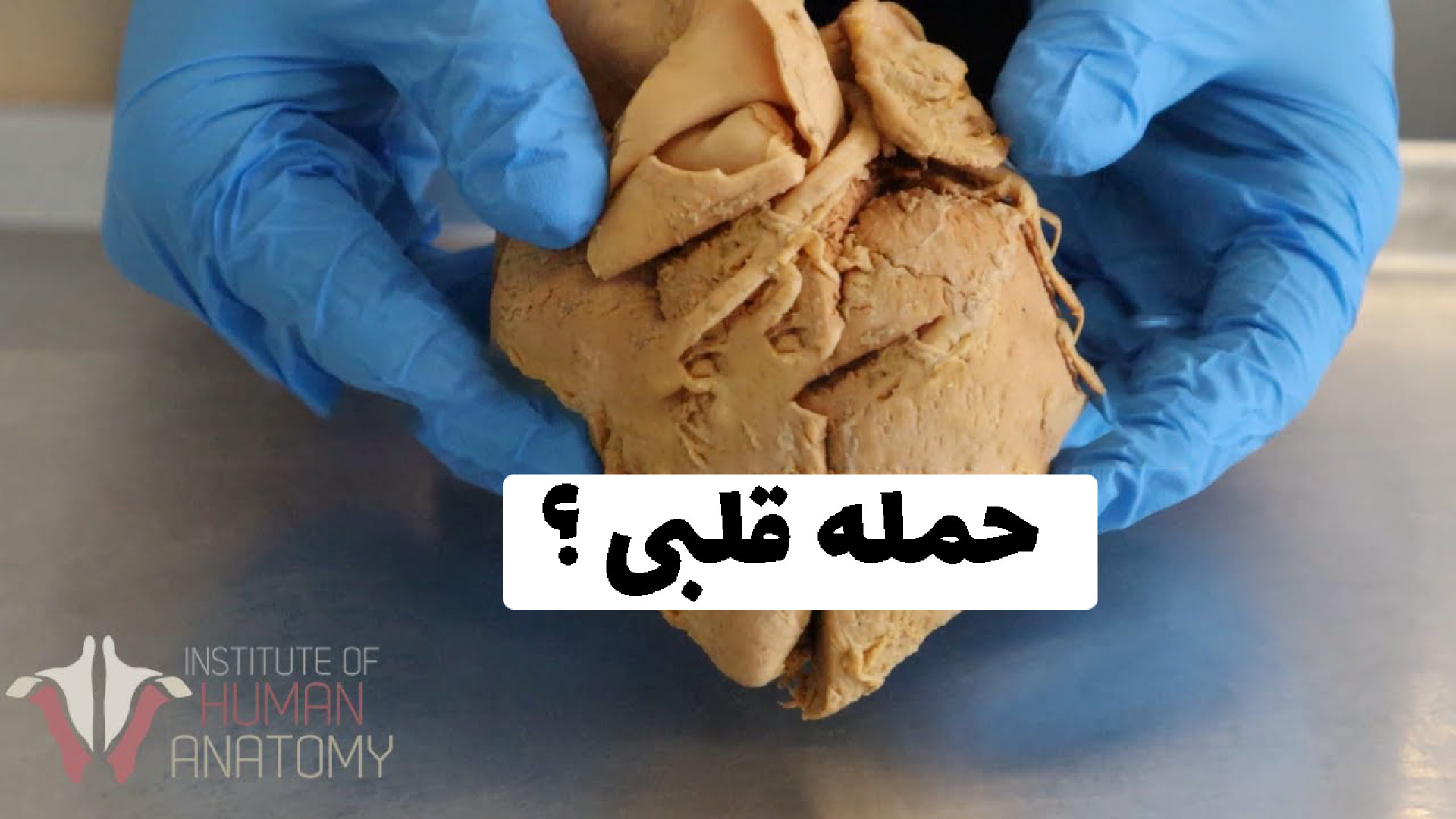آنچه در هنگام سکته قلبی اتفاق می افتد | آناتومی یک حمله قلبی کلینیک لیزر