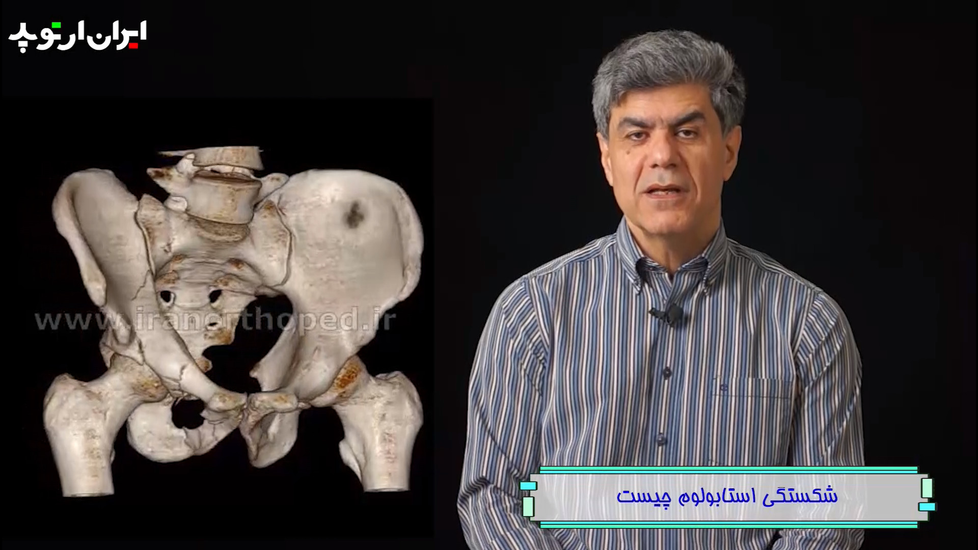 شکستگی استابولوم چیست اتوپلاستی