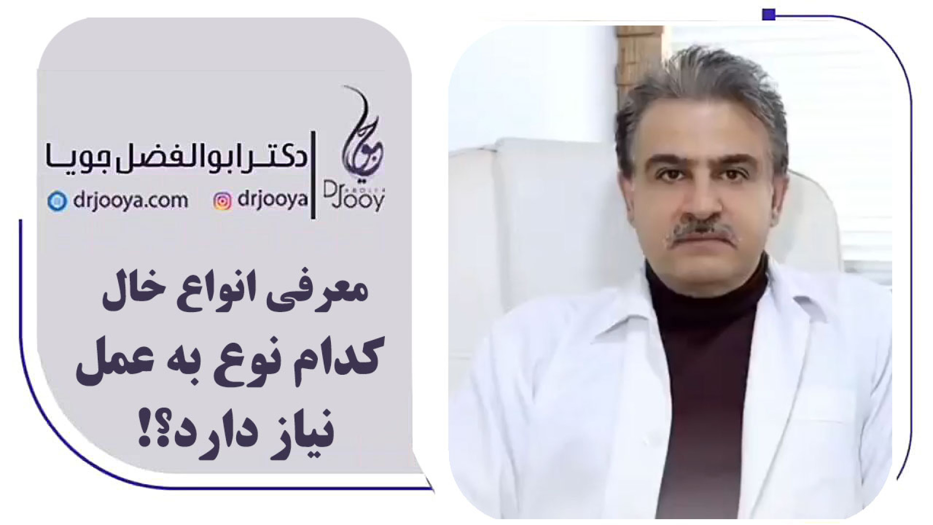 آیا خال روی صورت نگران کننده است؟ دکتر ابوالفضل جویا