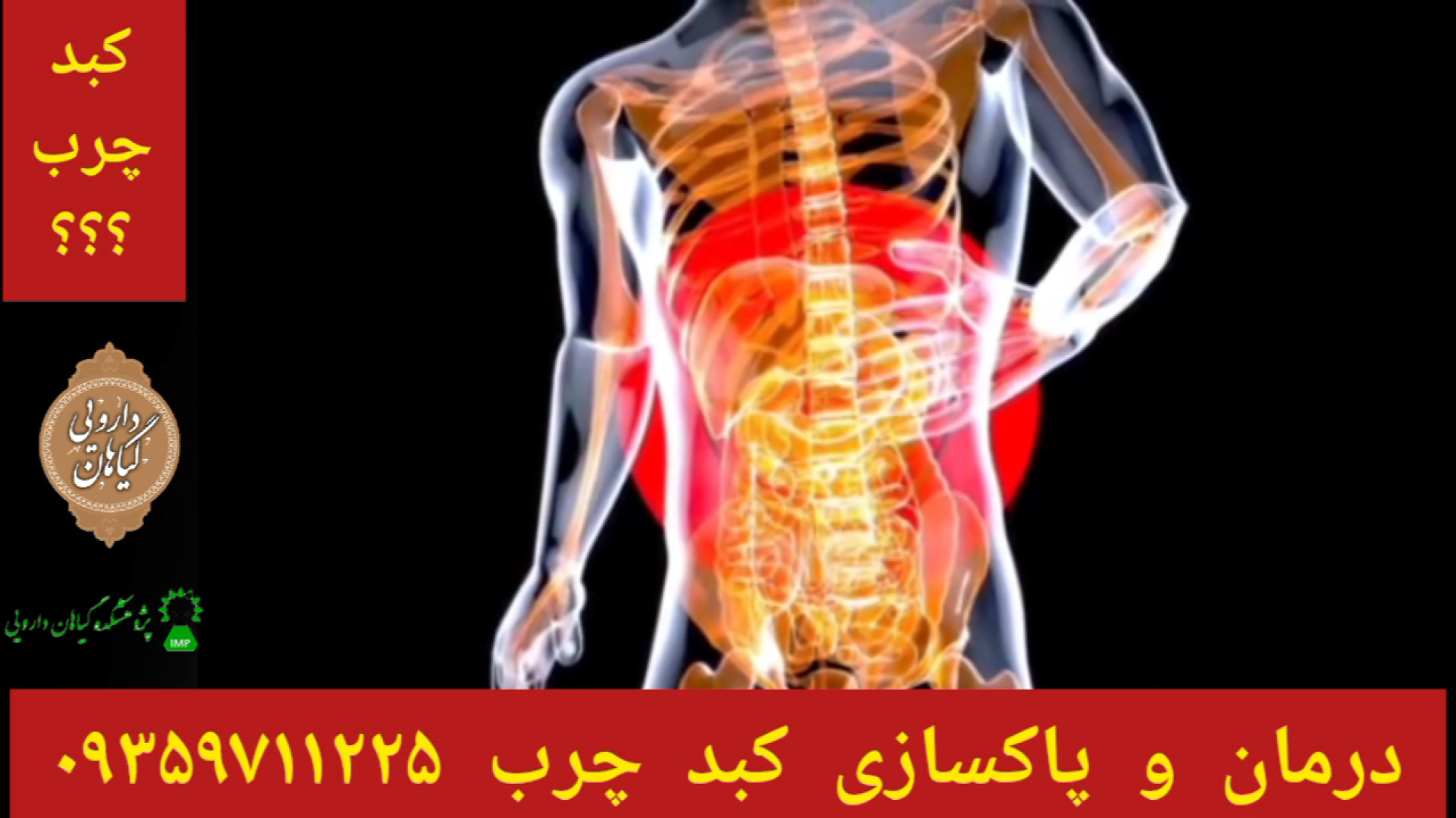 درمان و پاکسازی کبدچرب توسط شاگردان حکیم خیراندیش ۰۹۳۵۹۷۱۱۲۲۵ برداشتن خال