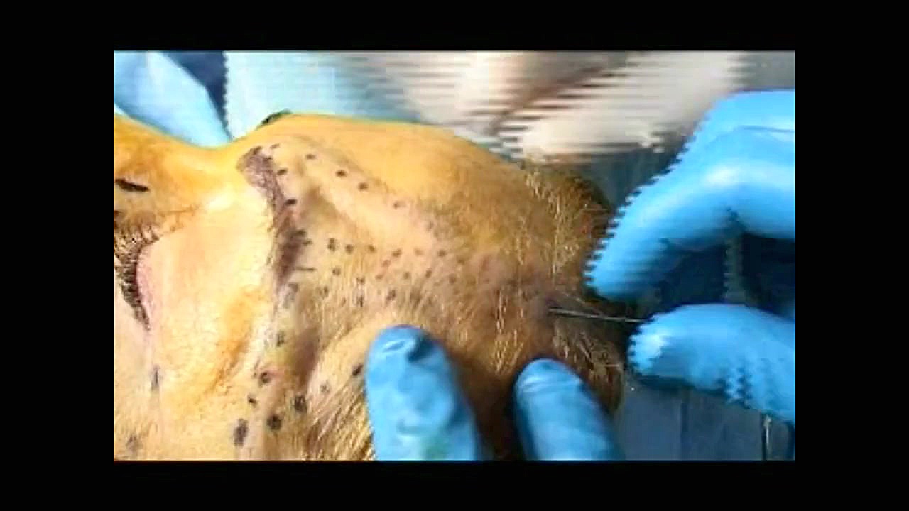 لیفت ابرو فرمانزوماب