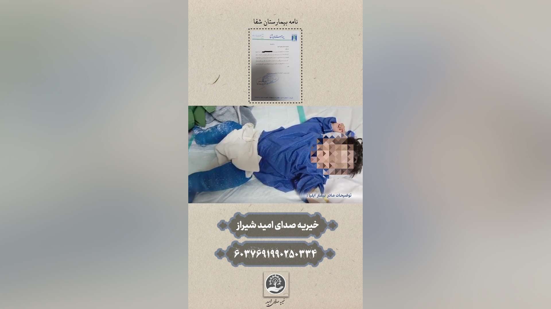 ایلیا | کودک یک ساله ای که با مشکل کلاب فوت پا درگیر است و نیاز به حمایت دارد. بلیچینگ