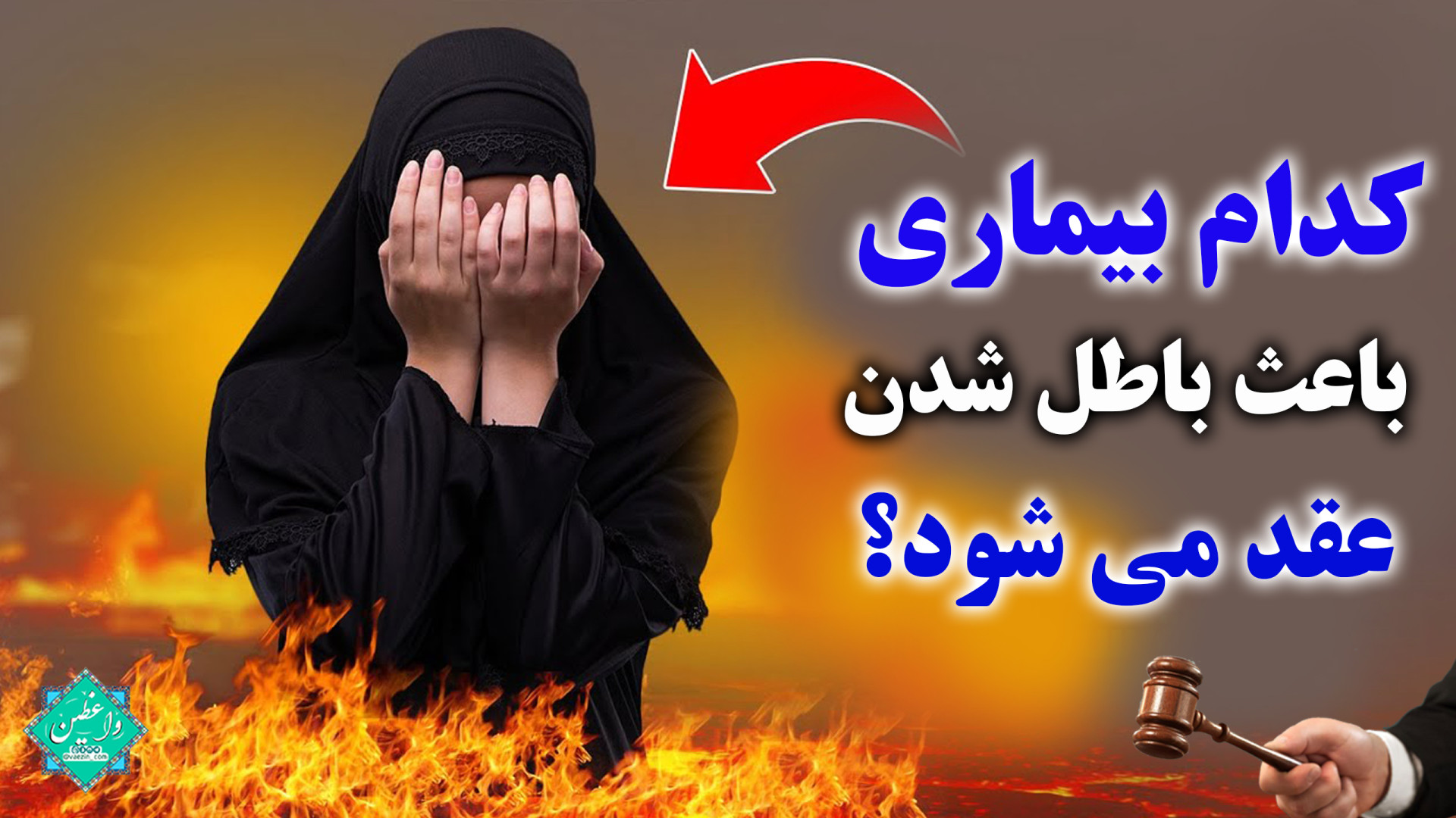 کدام بیماری باعث باطل شدن عقد می شود؟ اندودنتیکس