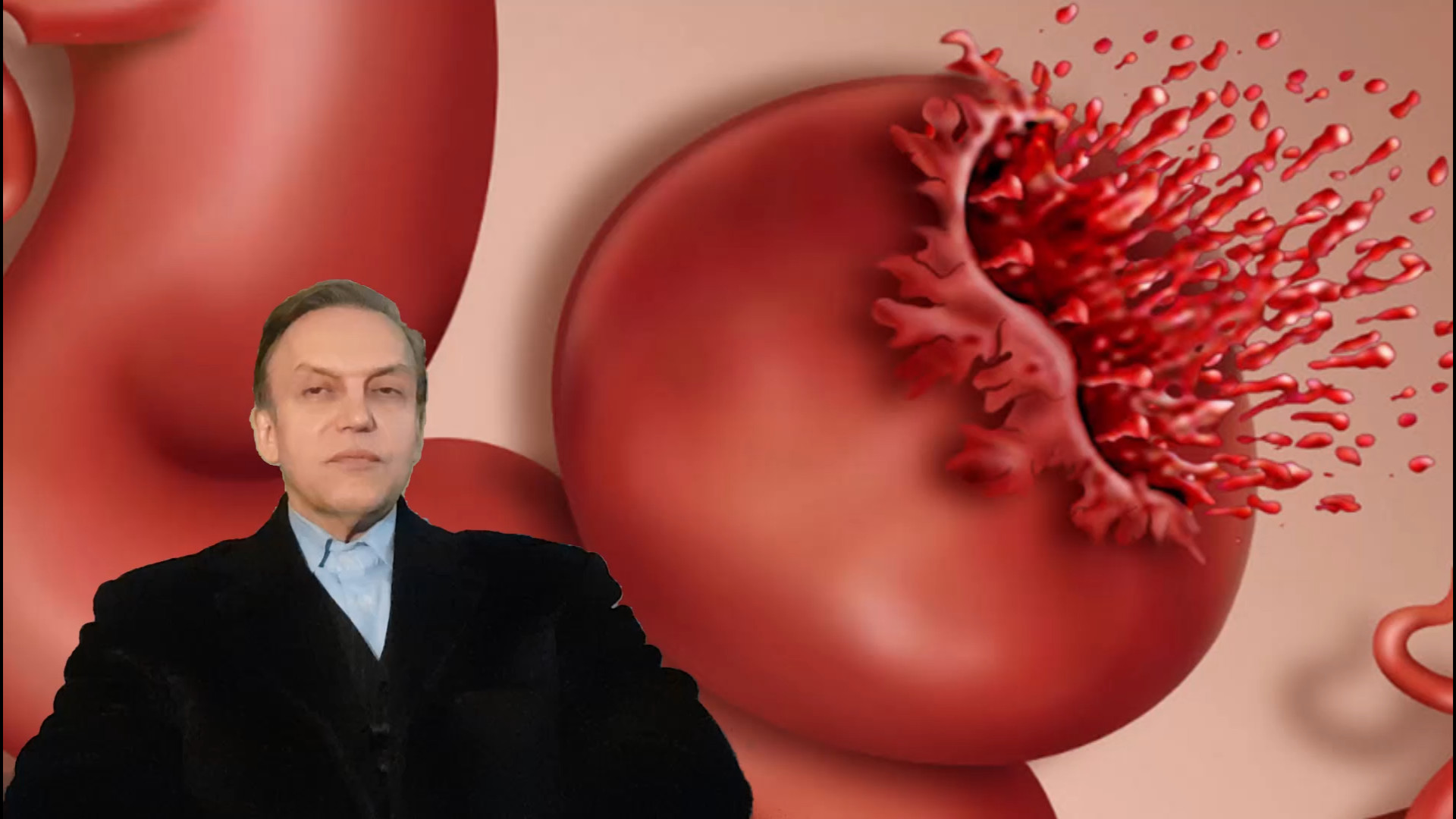 پرسش و پاسخ با استاد محمدرضا صفاری: علائم نشاندهنده بیماری آنوریسم برداشتن خال