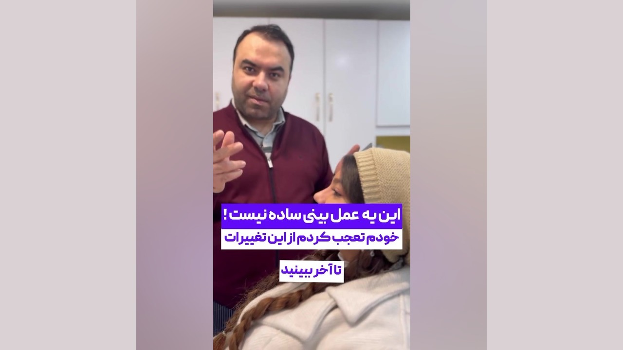 بهترین جراح بینی گوشتی در تهران دکتر علی شفیعی رونیزی | بهترین جراح بینی تهران