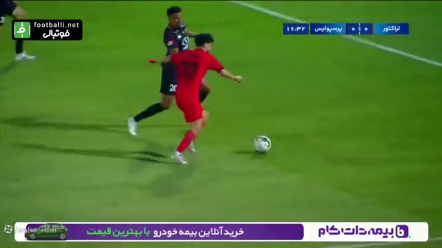 آلکسی گندوز لیزر مو