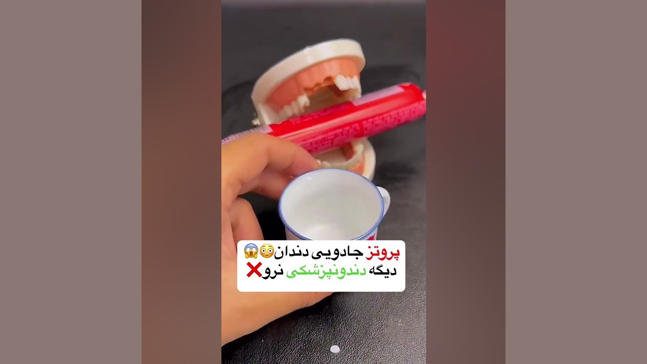پروتز دندان جادوئی پریودنتیکس
