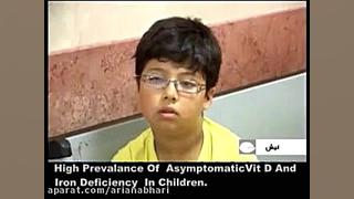vitamin D and iron deficiency In children کمبود آهن و ویتامین دی در بچه ها دندان مصنوعی