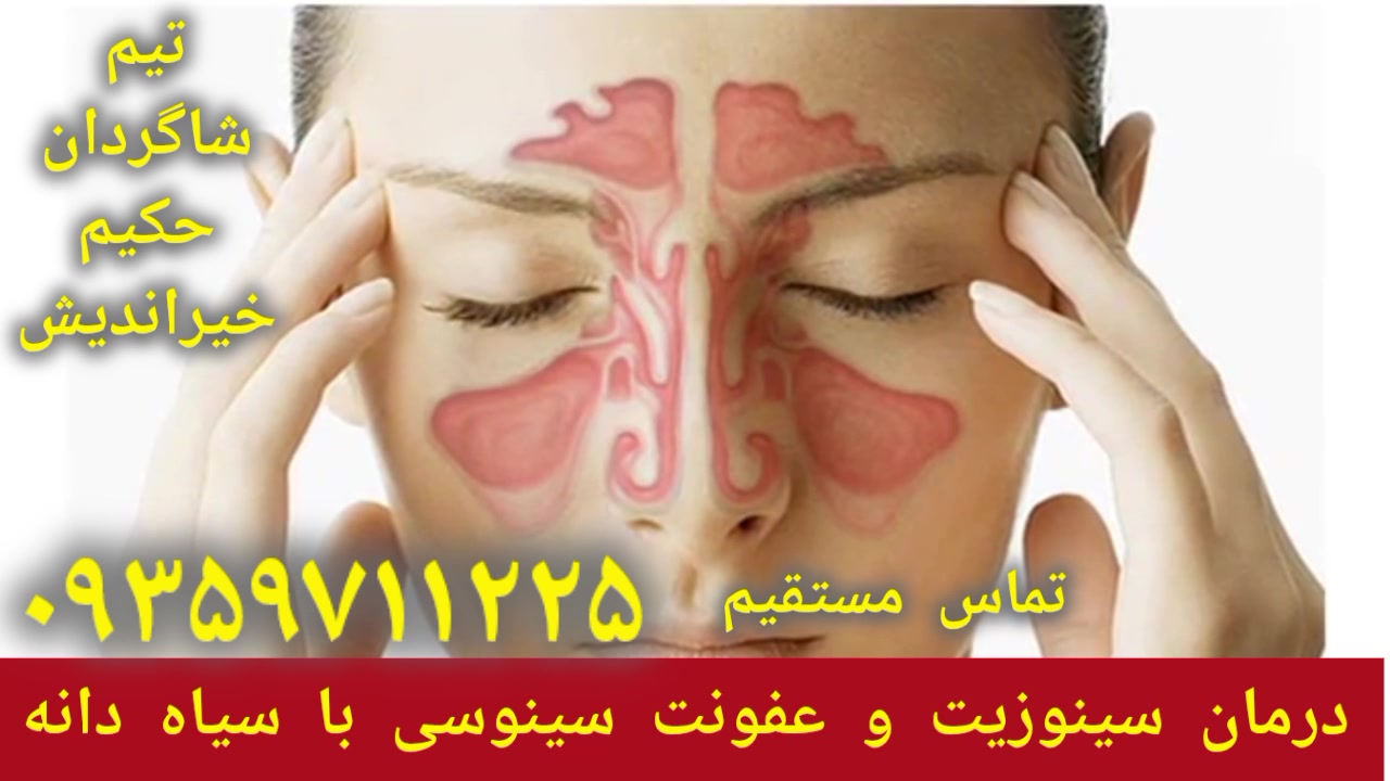 سیاه دانه و سینوزیت درمان میگرن و سردرد توسط شاگردان حکیم خیراندیش ۰۹۳۵۹۷۱۱۲۲۵ استریمر