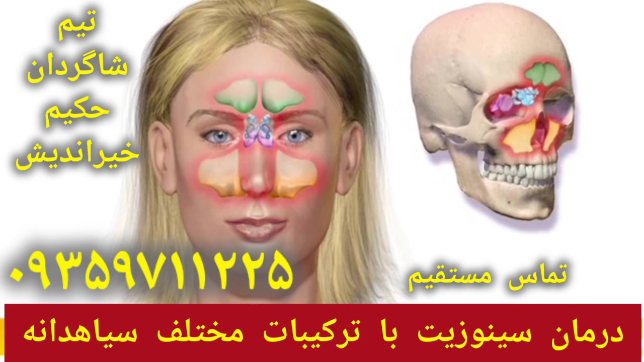 درمان سینوزیت با سیاهدانه درمان میگرن توسط شاگردان حکیم خیراندیش ۰۹۳۵۹۷۱۱۲۲۵ بازی کامپیوتری