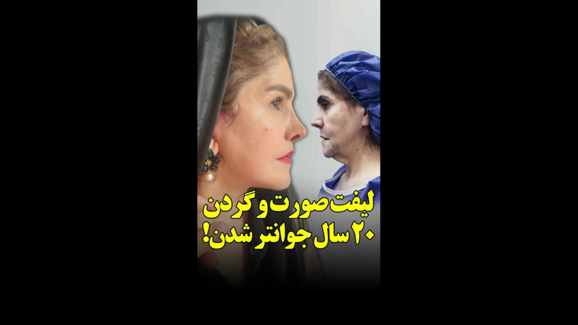 20 سال جوانتر شدن! | لیفت صورت و گردن و سانترال لب گالکانی زوماب
