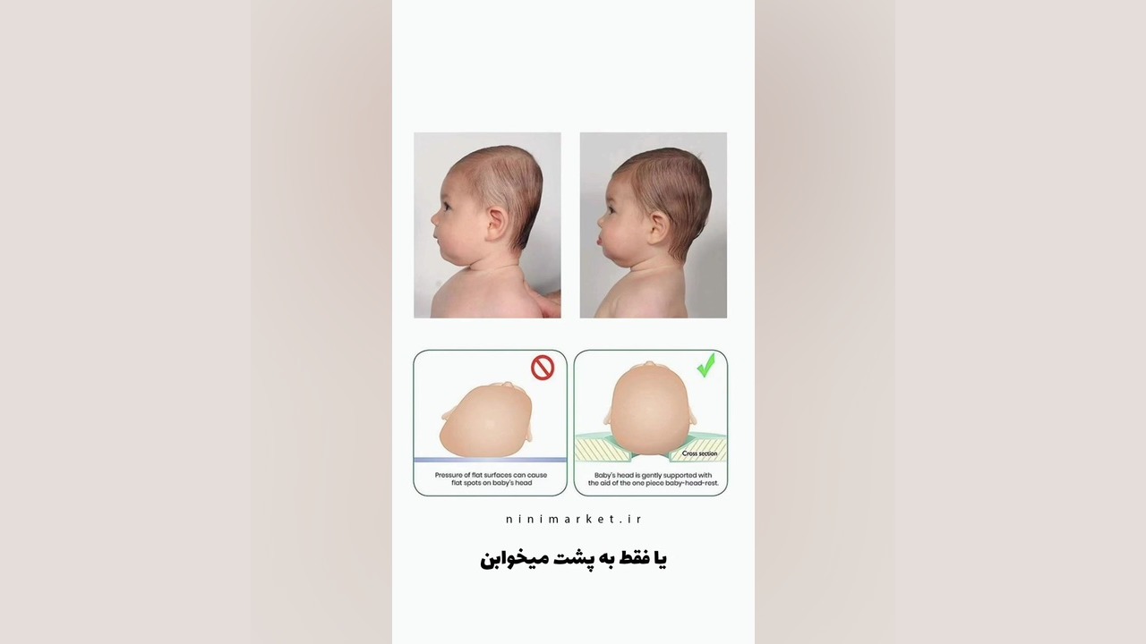 بالشت فرم دهی سر نوزاد ترمیم ونیر