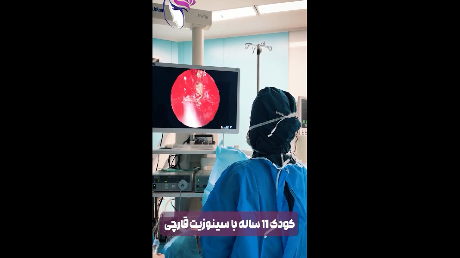 درمان سینوزیت قارچی چارلیز ترون