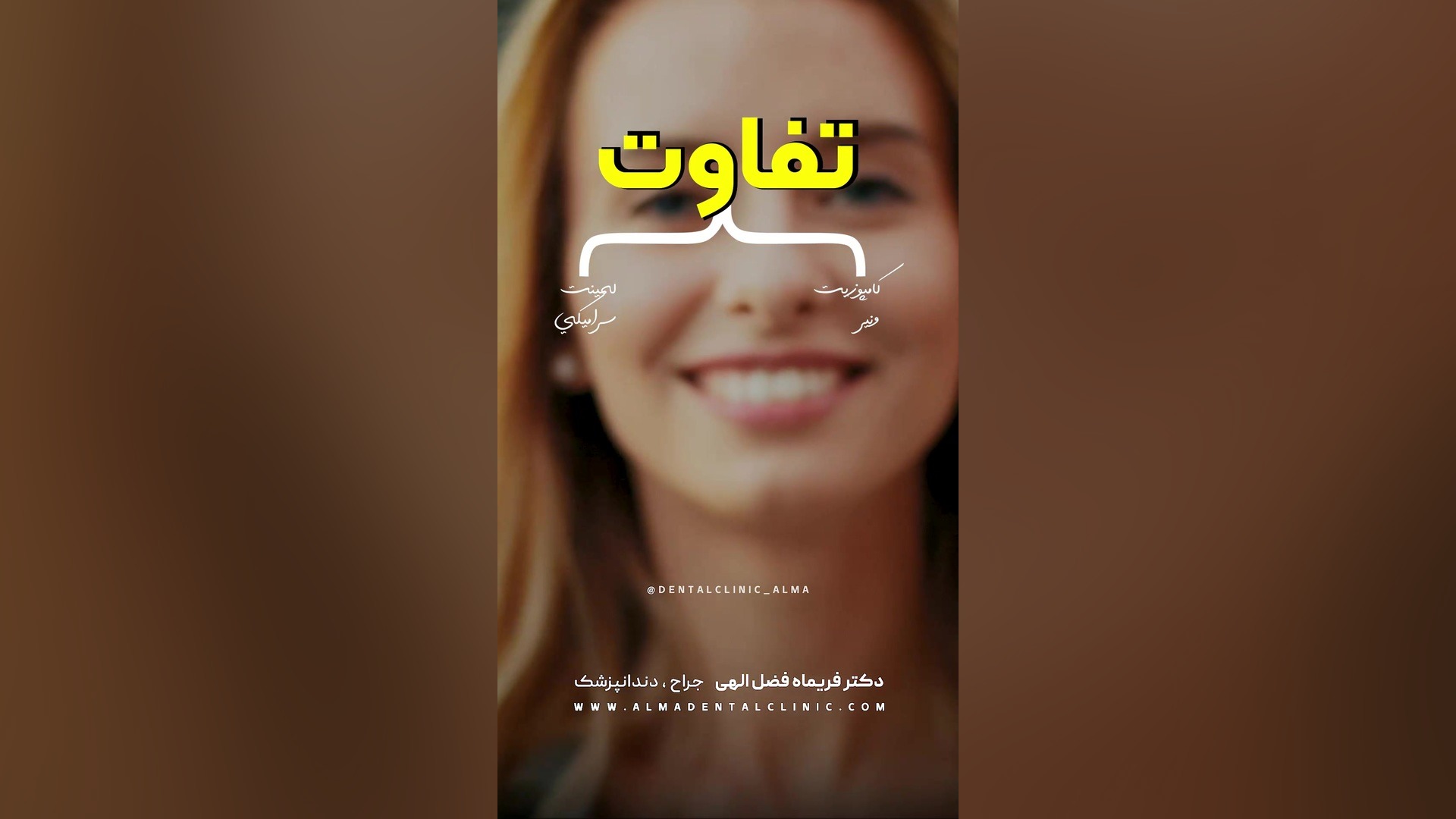 تفاوت کامپوزیت ونیر و لمینت سرامیکی دکتر فریماه فضل اللهی