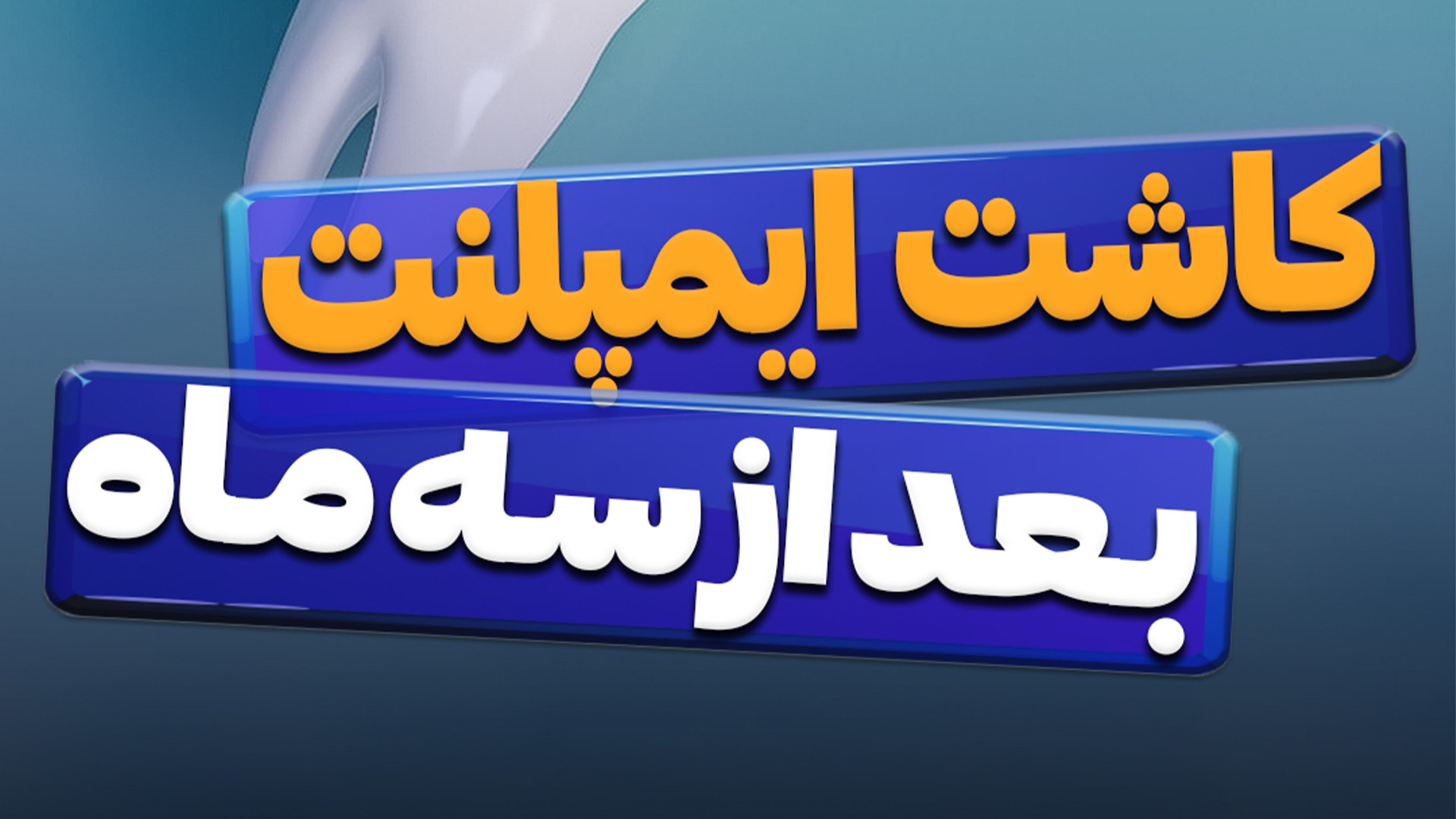 کاشت ایمپلنت بعد از سه ماه بیولوژی پرتوی