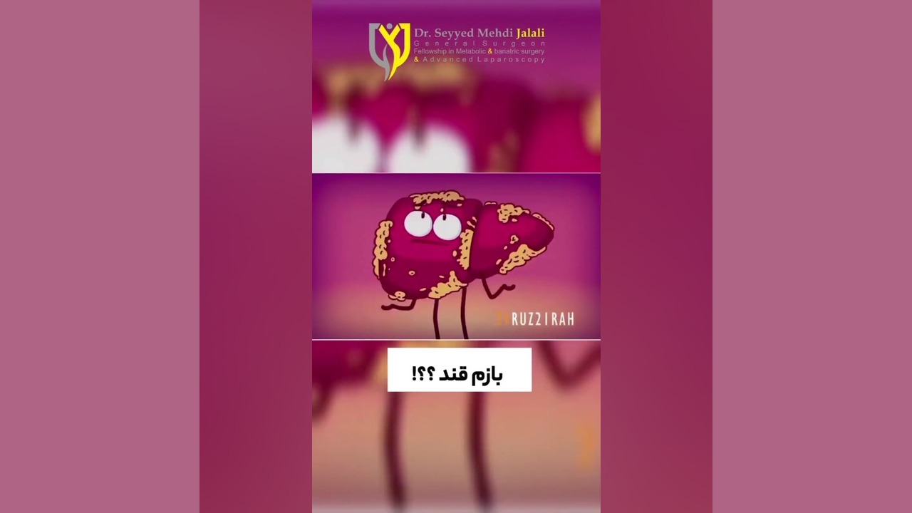 انیمیشن مقاومت به انسولین پوسیدگی دندان