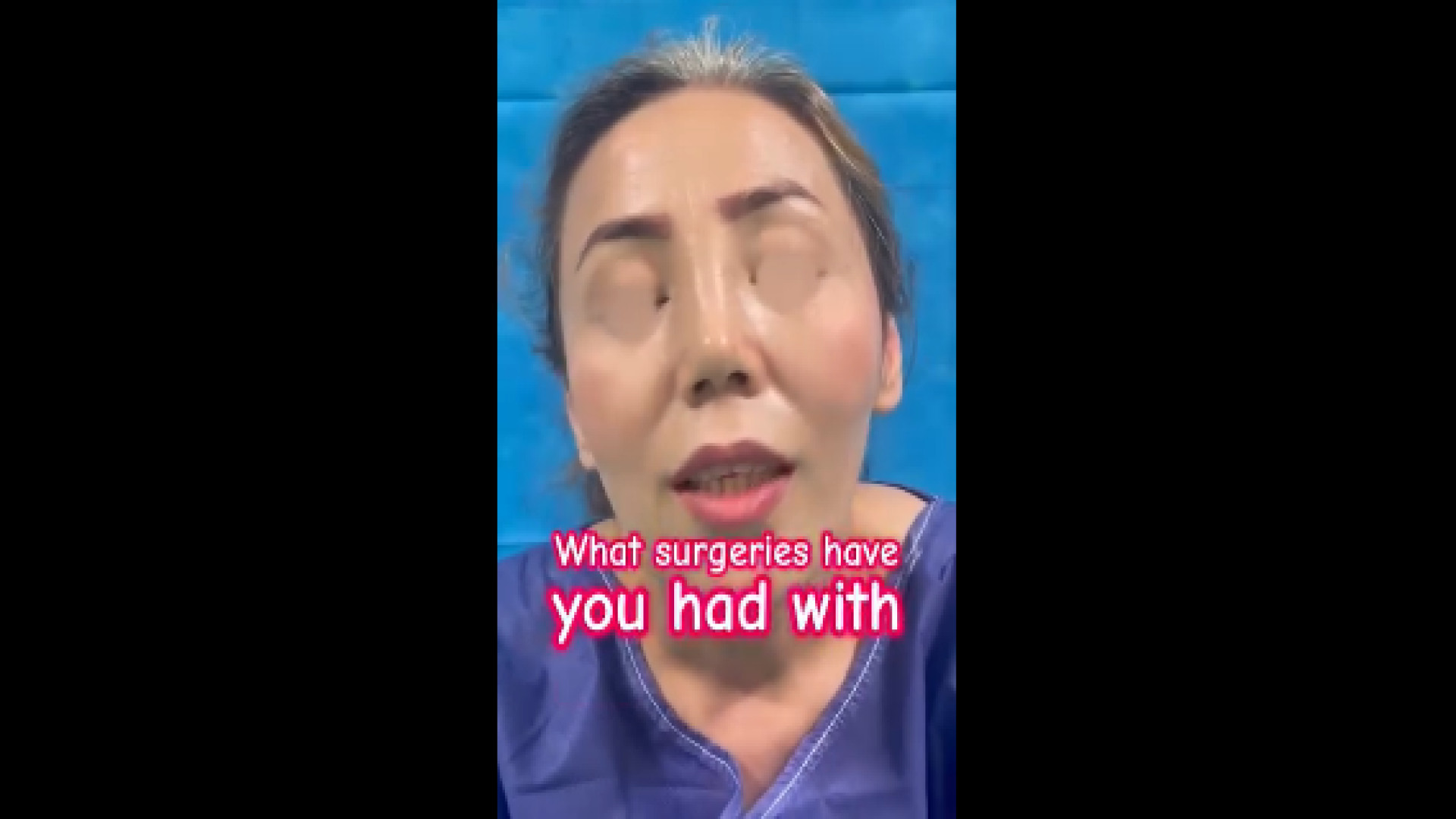 نتایج یک ماه بعد از جراحی رینوپلاستی، گونه و فک دکتر حمید رضا فتحی فوق تخصص جراحی پلاستیک