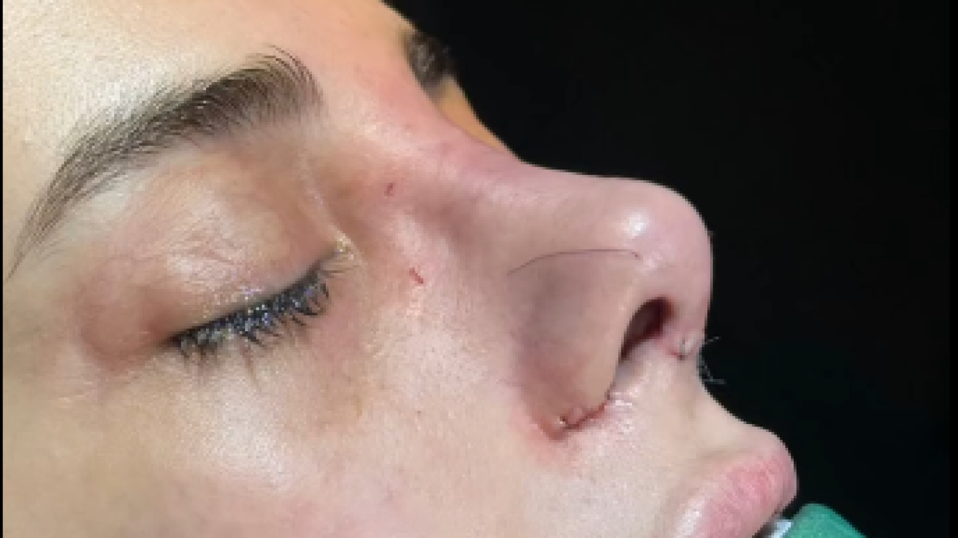 بینی شیک و دخترانه | دکتر علی باقری حق دکتر علی باقری حق