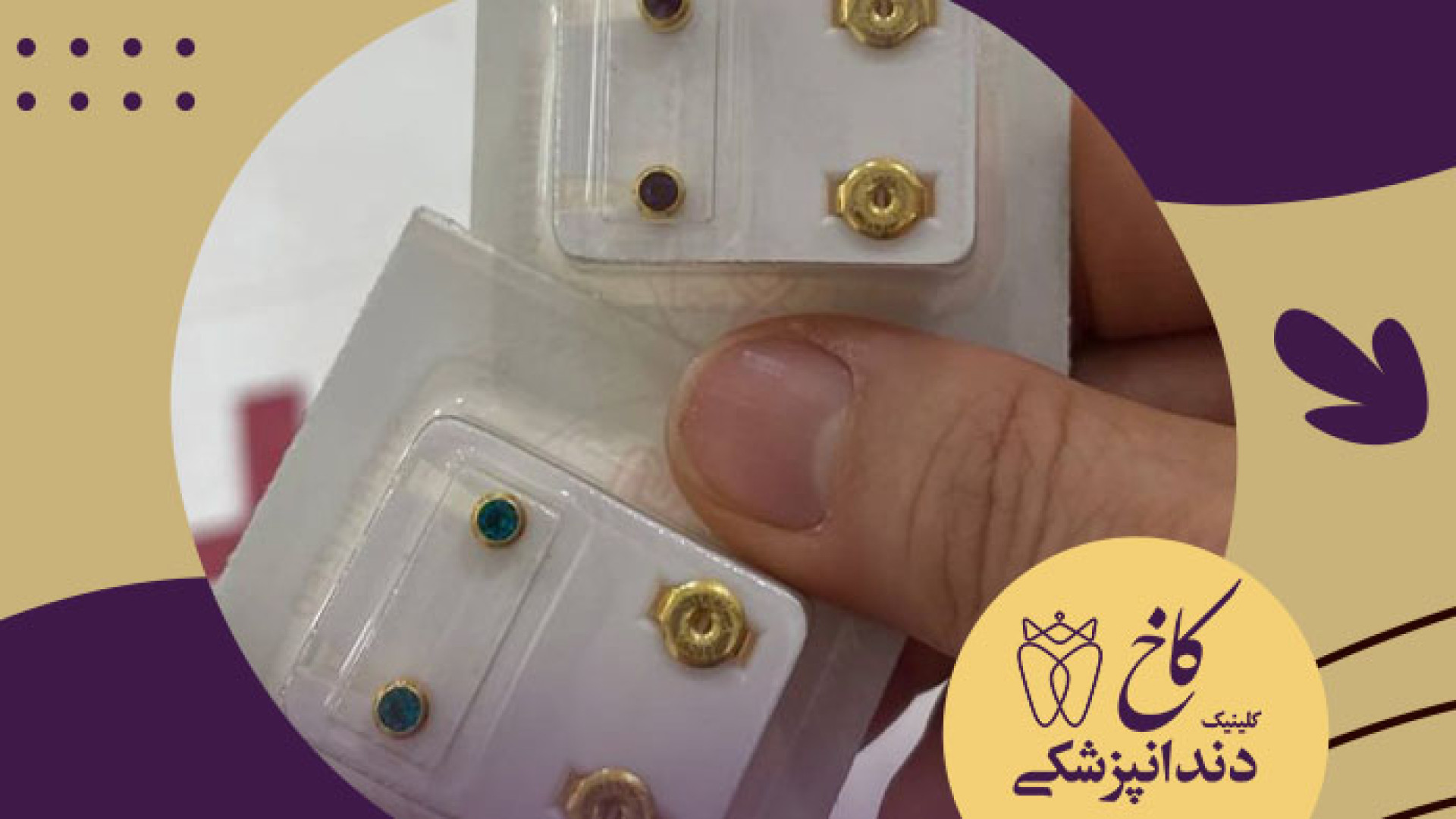 سوراخ کردن گوش با بیهوشی کلینیک دندانپزشکی کاخ