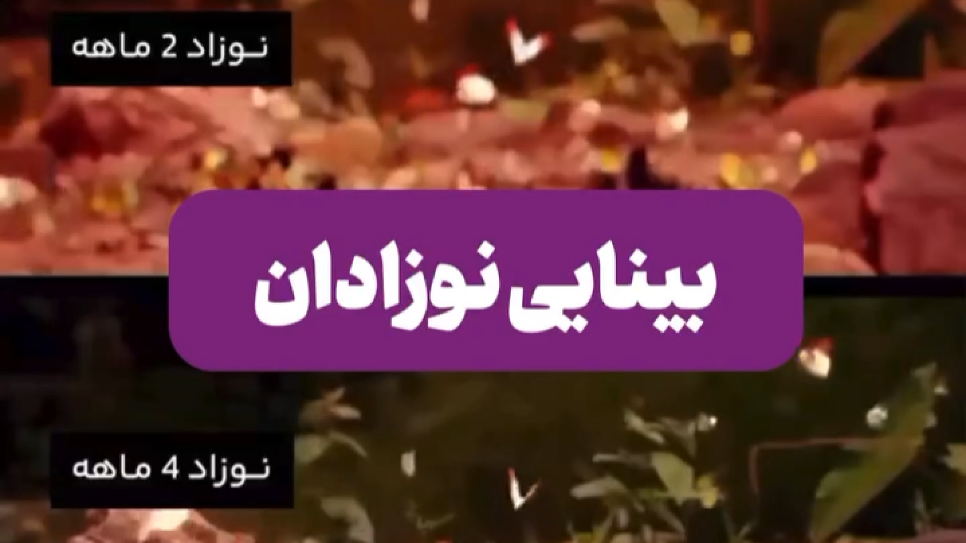 بینایی نوزادان در ماه‌های مختلف لیزر مو