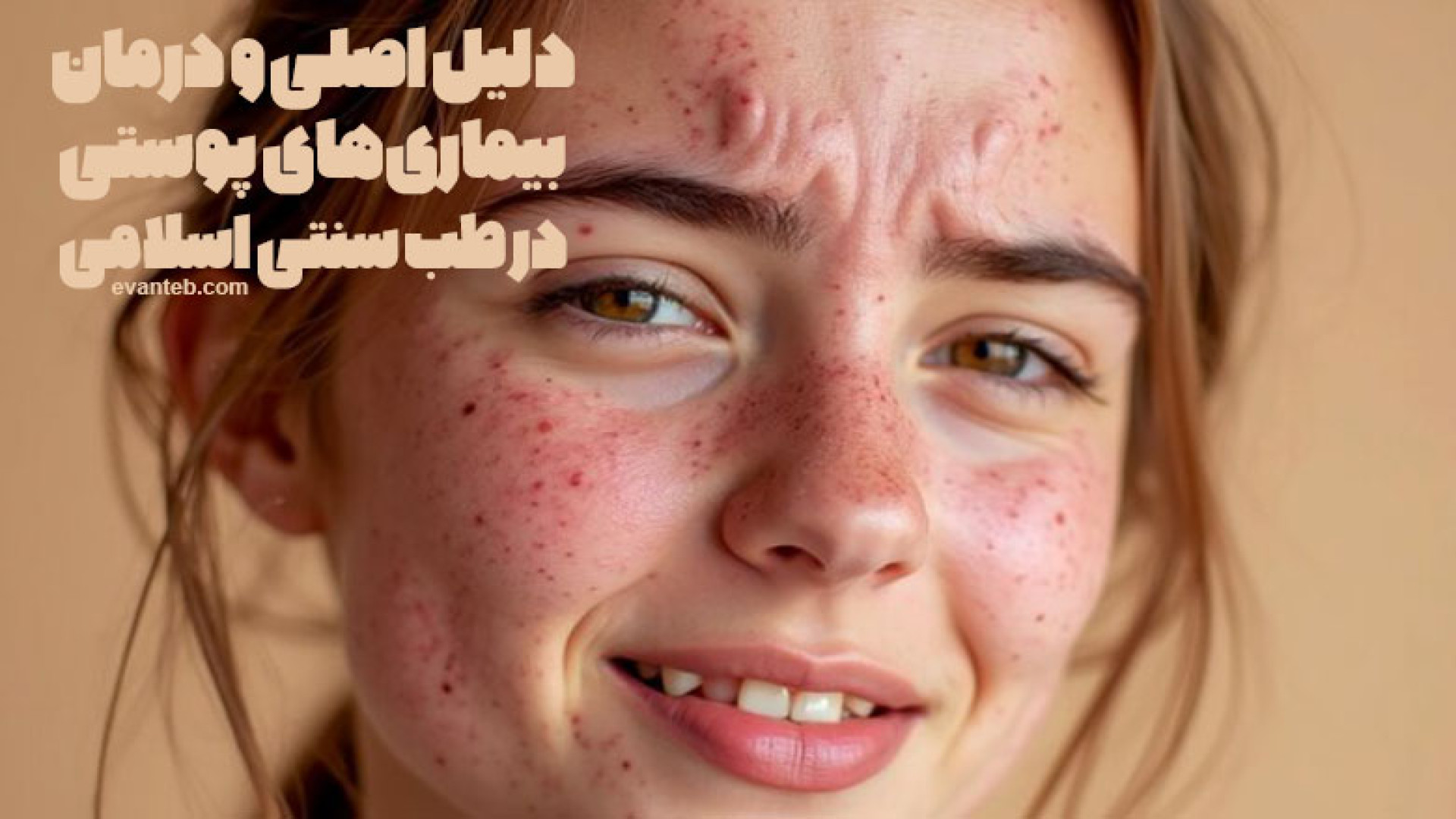 دلیل اصلی و راهکار درمان بیماری های پوستی و داشتن پوست شفاف در طب سنتی اسلامی میلوشل
