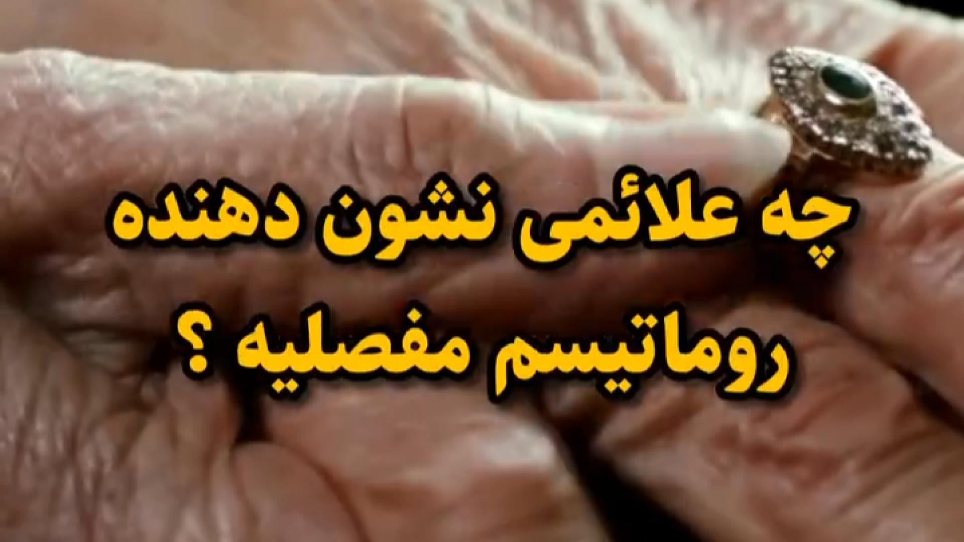 علائم روماتیسم مفصلی دندان مصنوعی