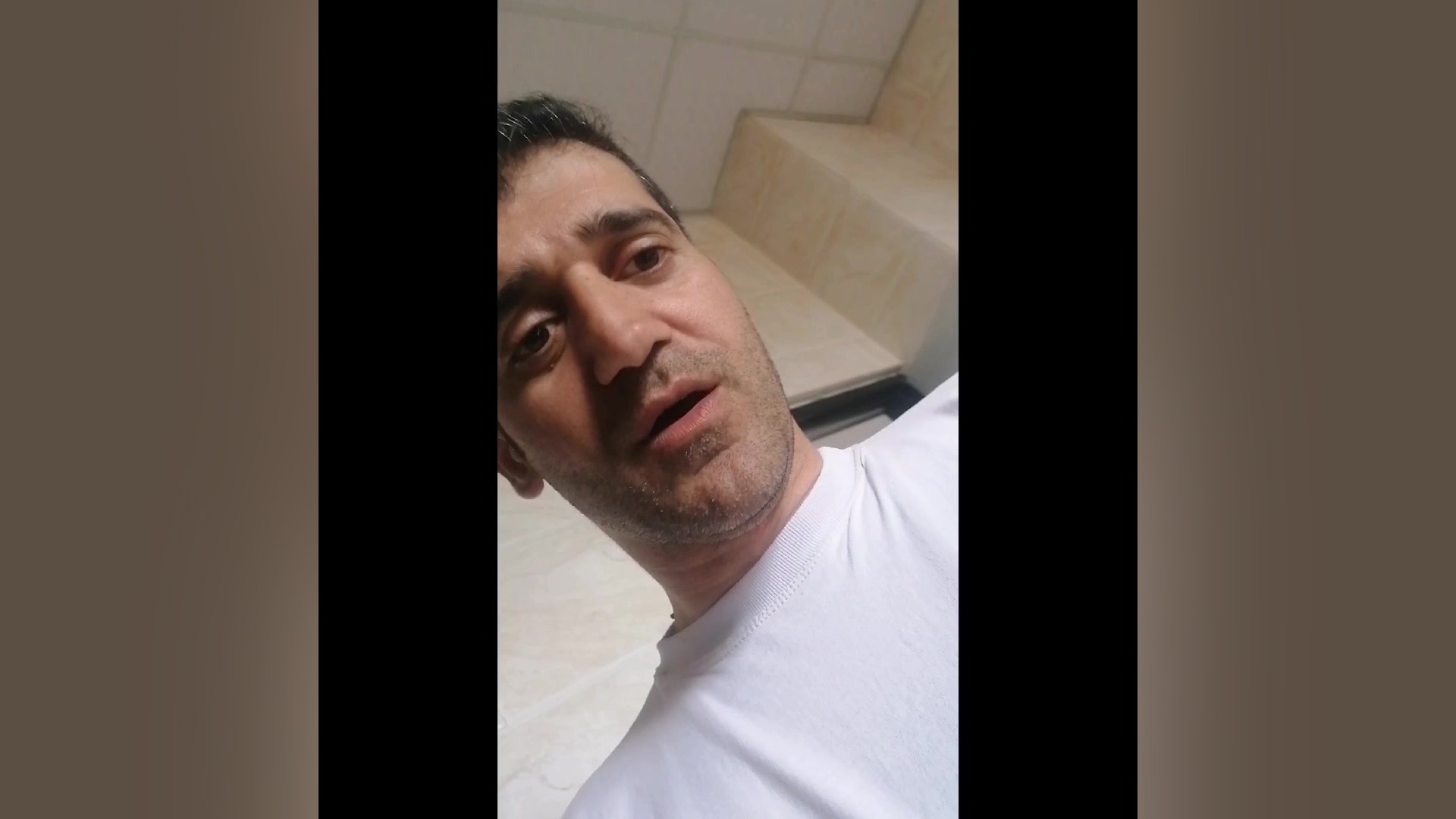 رفع آفتاب سوختگی چراغ جلوی ال نود جراحی بینی