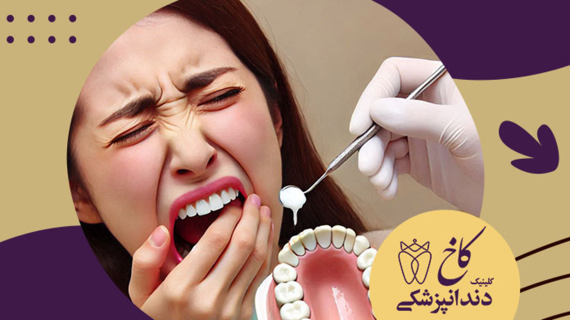 قالب گیری دندان کلینیک دندانپزشکی کاخ