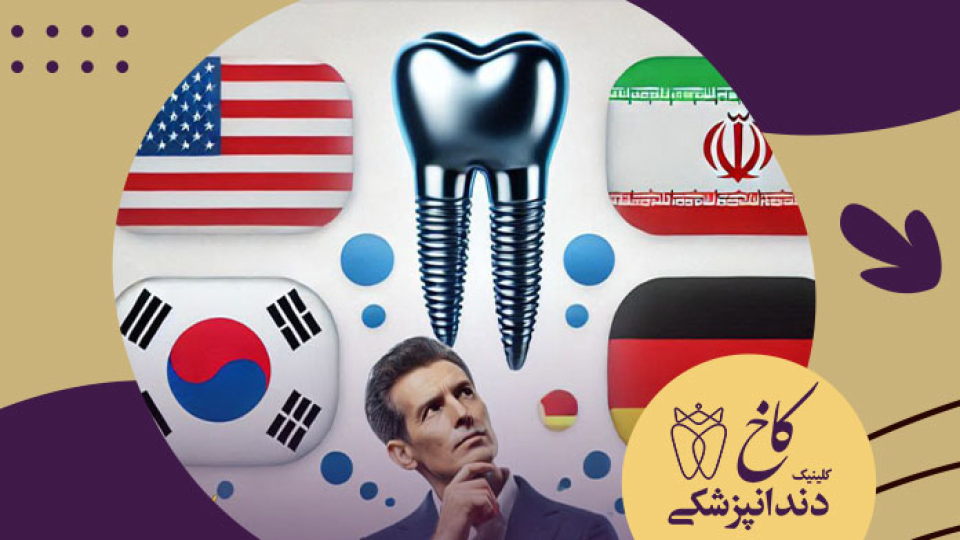 بهترین برند های ایمپلنت کلینیک دندانپزشکی کاخ