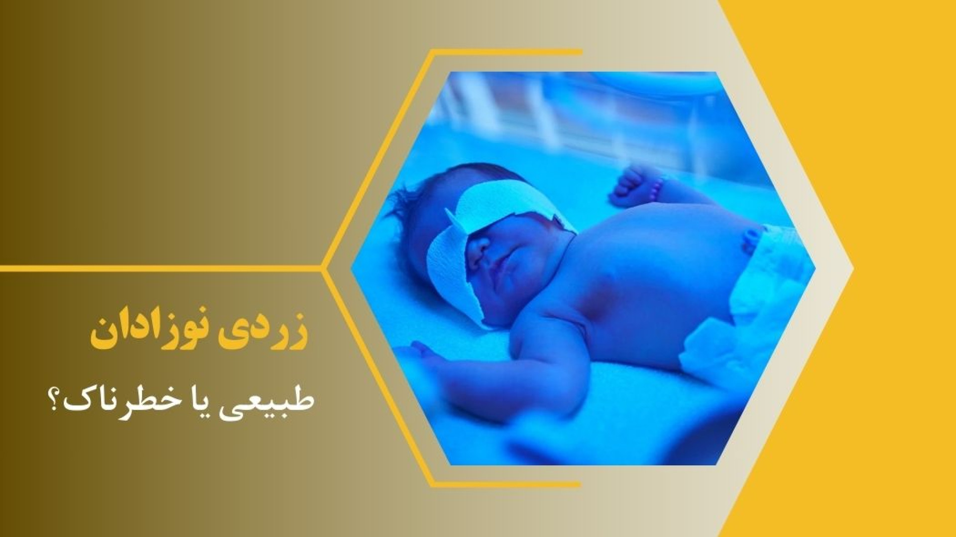 زردی نوزادان؛ طبیعی یا خطرناک؟ PVRژنتیک پزشکی پیشرفته