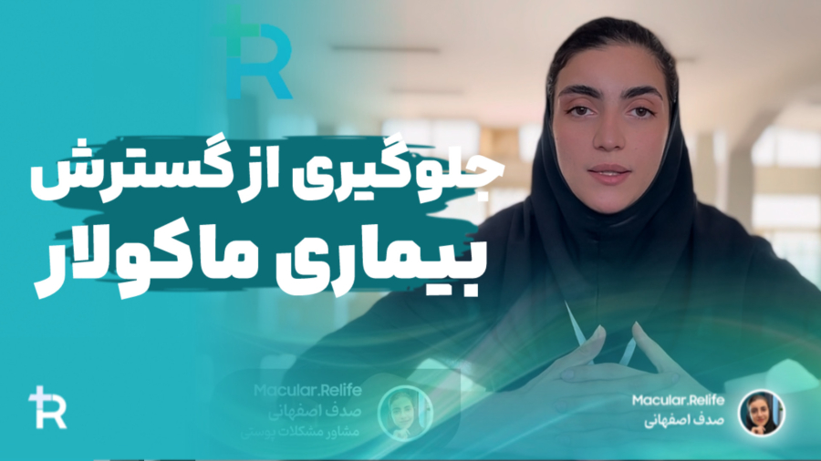 چگونه از گسترش ماکولار آمیلوئیدوز جلوگیری کنیم؟ | صدف اصفهانی پژوهشگر ارشد