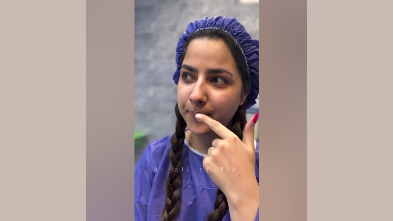 عمل بینی با قیمت مناسب در تهران دکتر علی شفیعی رونیزی | بهترین جراح بینی تهران