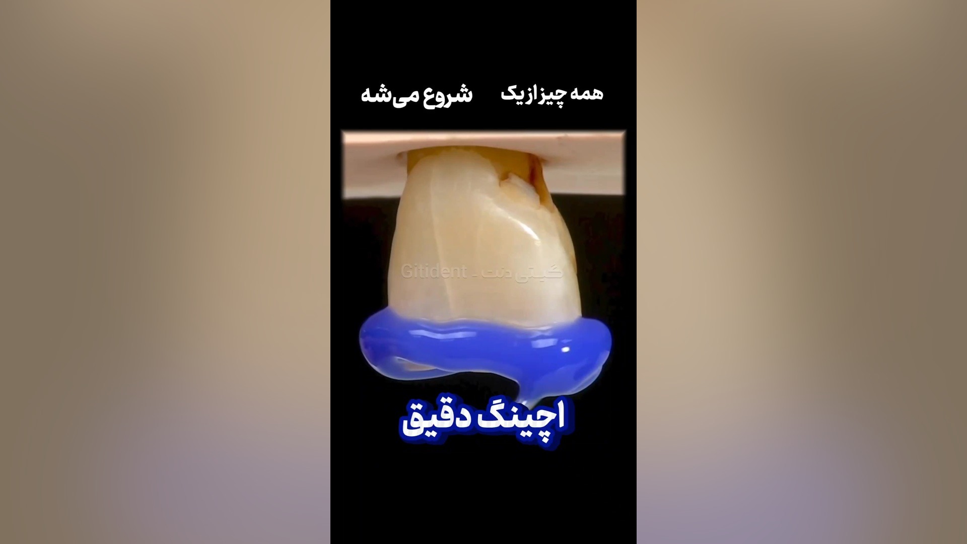 اسید اچ 37% مروابن دستگاه Cell Sorter