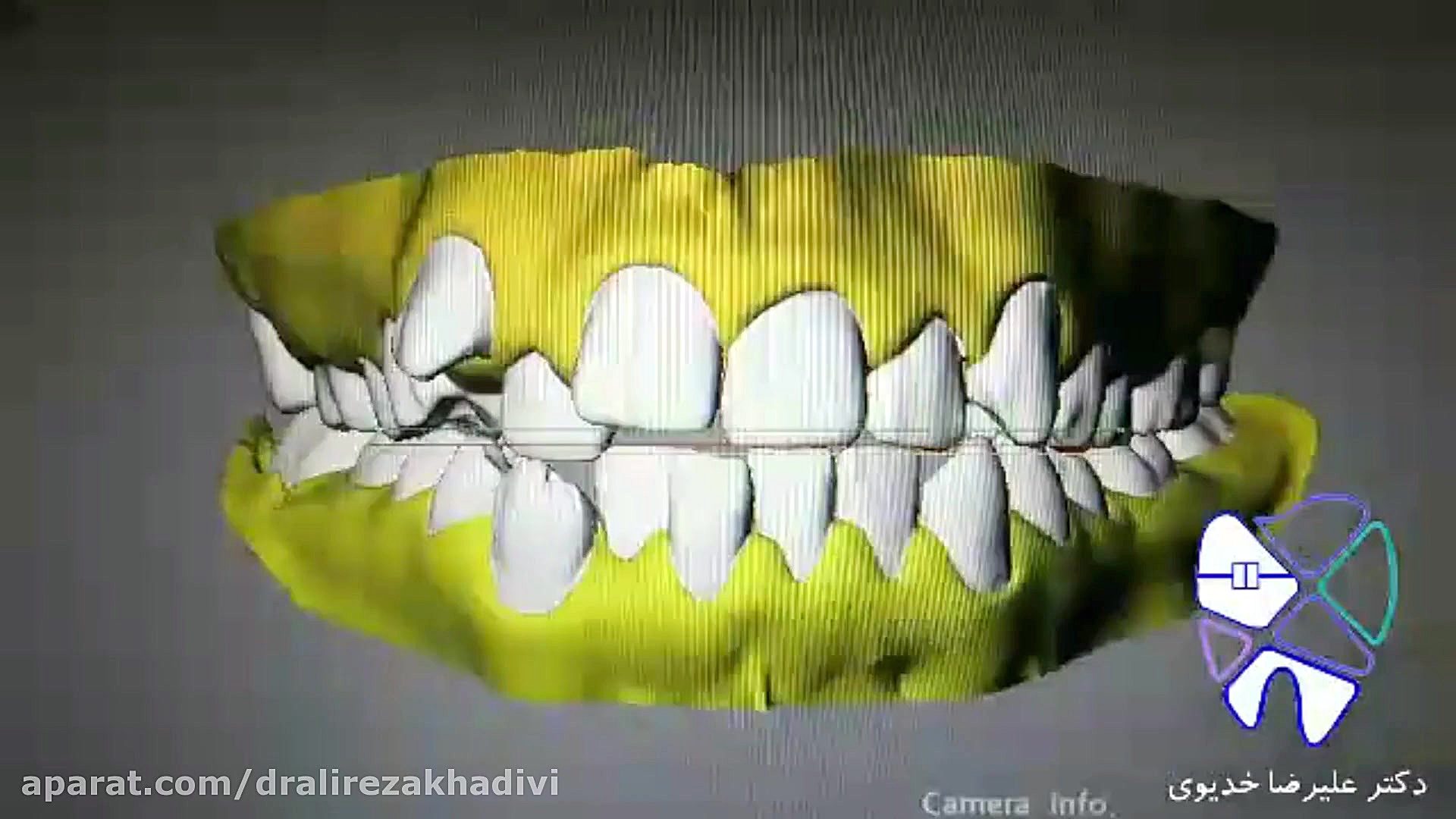 انواع دندانهای نامرتب دکتر علیرضا خدیوی