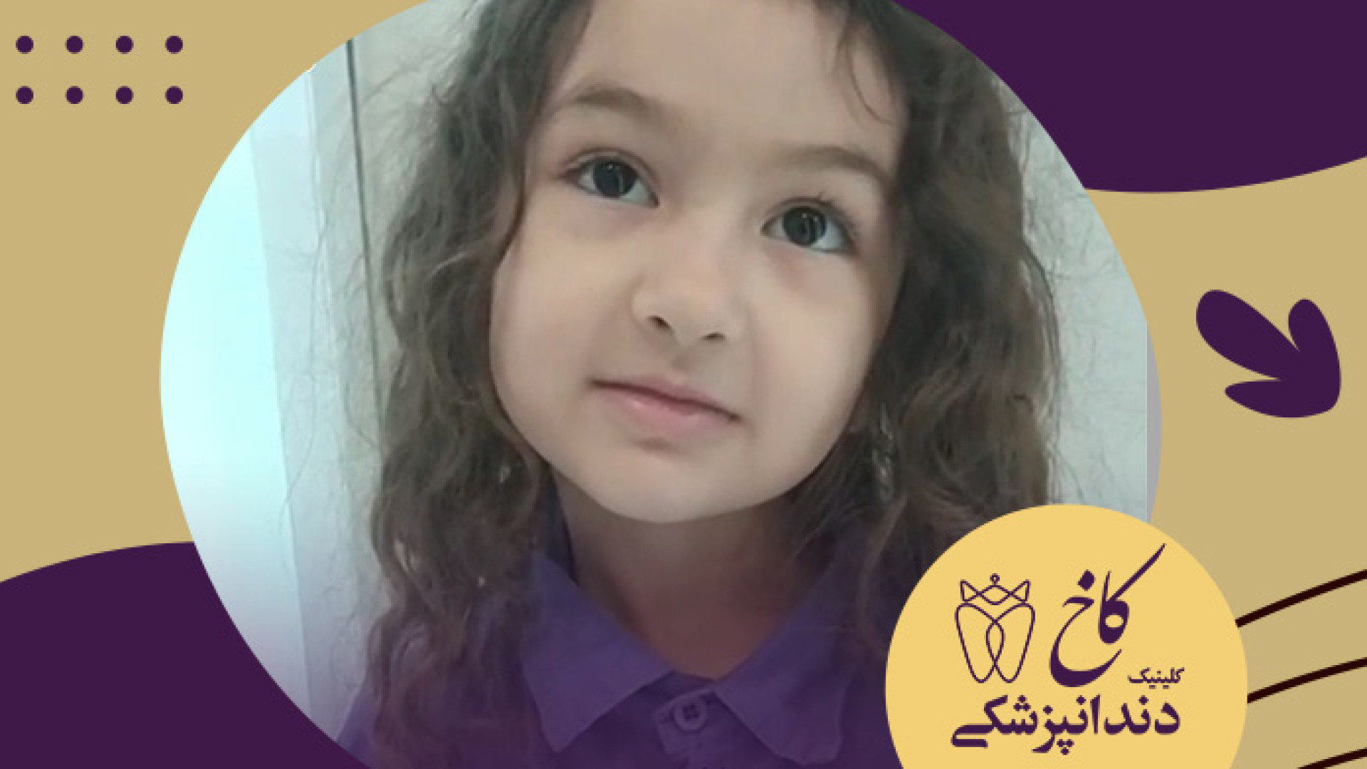دندانپزشکی با بیهوشی کودکان (موهای قشنگ محیا) لیفت ابرو