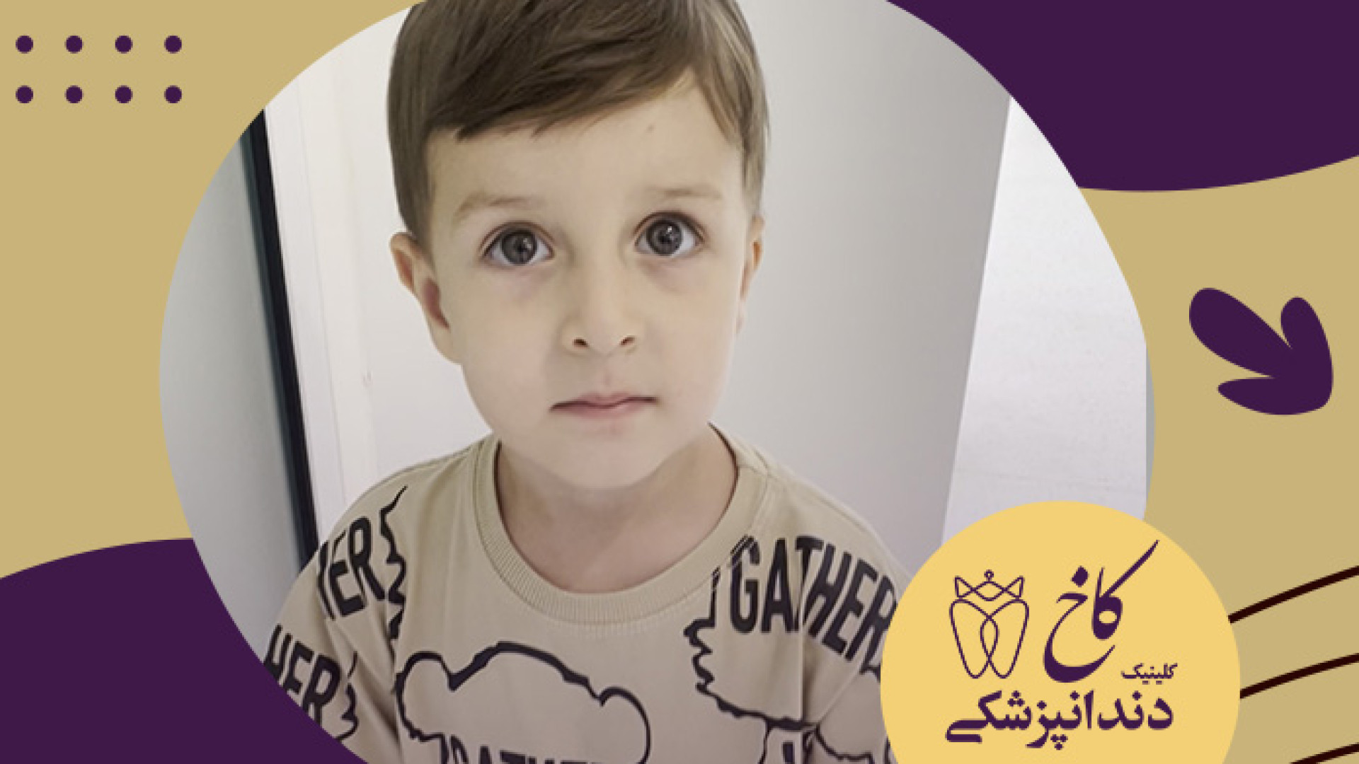 دندانپزشکی با بیهوشی برای کودکان کلینیک دندانپزشکی کاخ