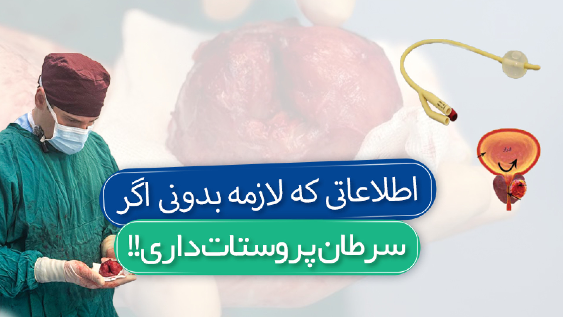 جراحی سرطان پروستات آر اف فرکشنال