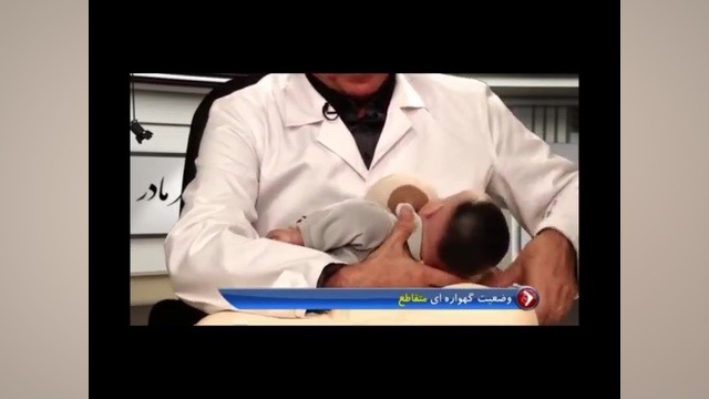 روش گهواره ای متقابل هنگام شیردهی نوروپروستتیک