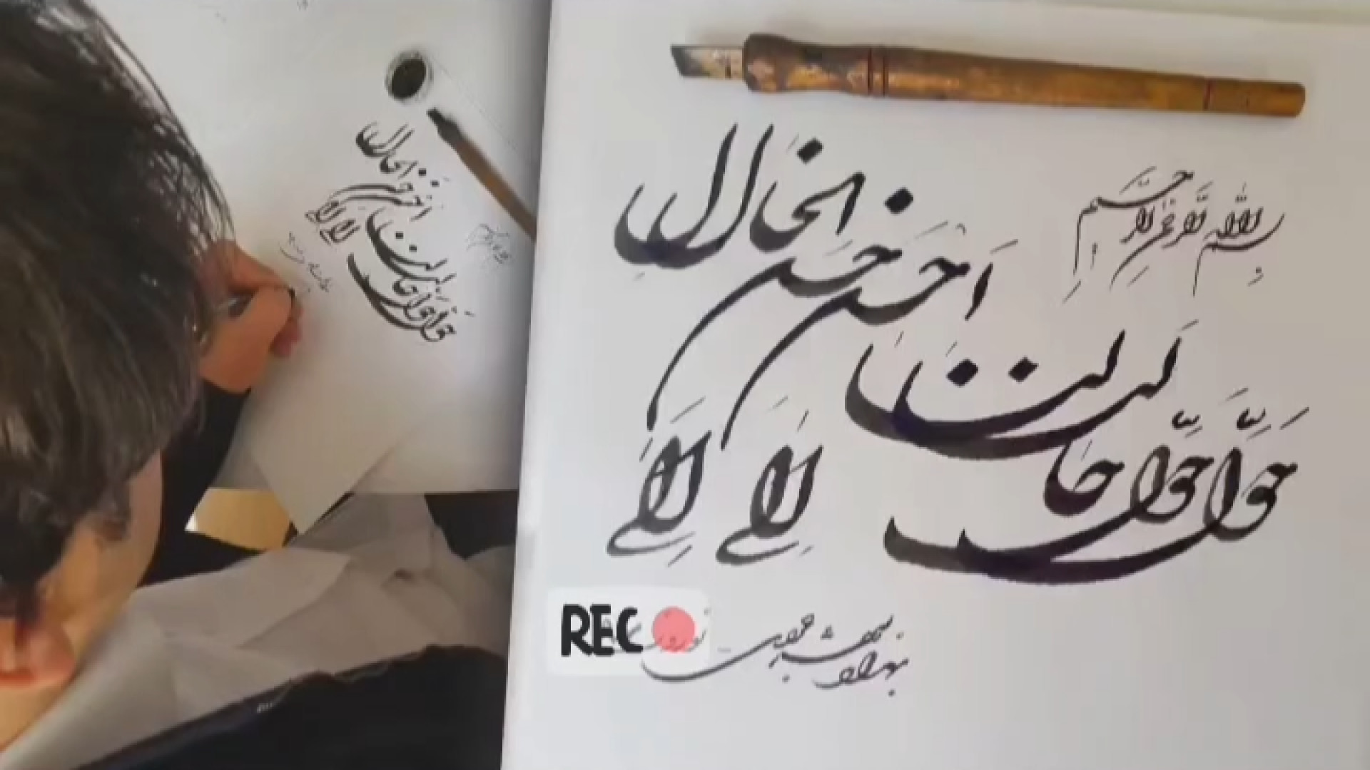 دکتر بهزاد شهرجردی متخصص و جراح گوش ، حلق ، بینی و سرو گردن جراحی پف زیر چشم